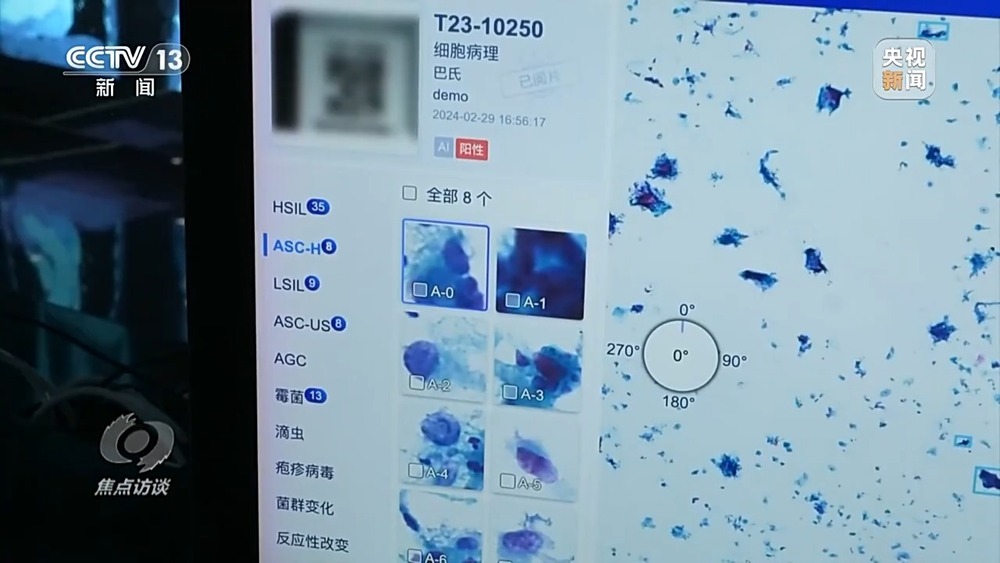 焦点访谈丨辅助诊断、AI问答、健康管理……AI正重塑医疗服务链条(图18)