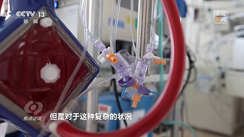 焦点访谈丨辅助诊断、AI问答、健康管理……AI正重塑医疗服务链条(图15)